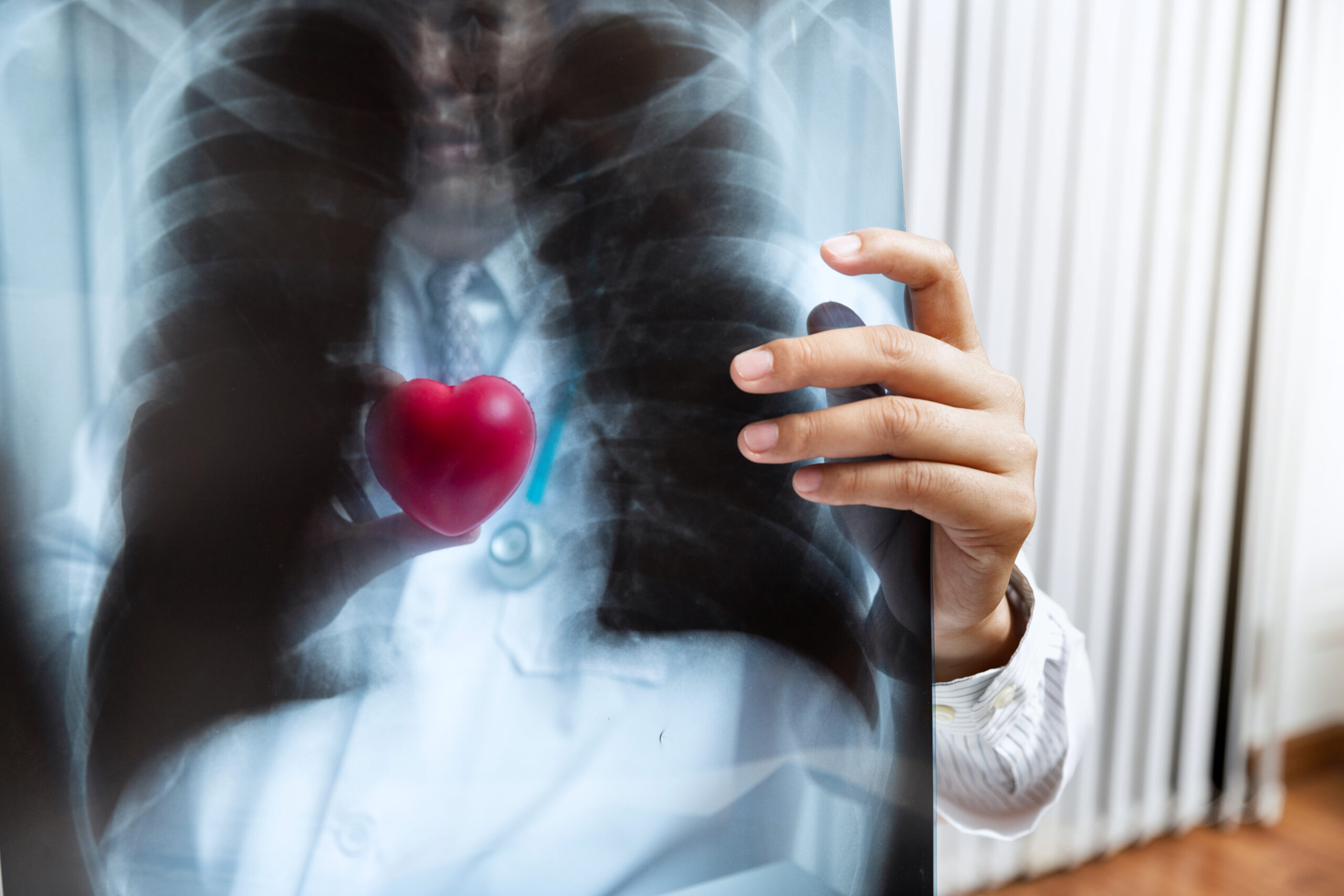 Pulmonale Hypertonie (PAH)